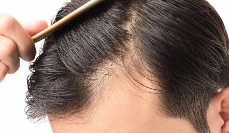 Dengan Diagnosa Penyakit Melalui Rambut, Tak Perlu Lagi Kontak Fisik Dokter dengan Pasien
