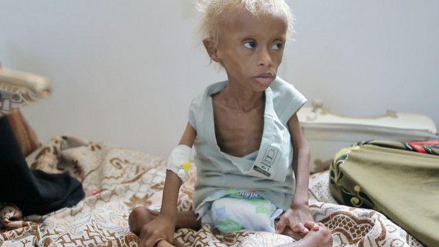 Yaman Yang Kini Sedang Menangis Darah